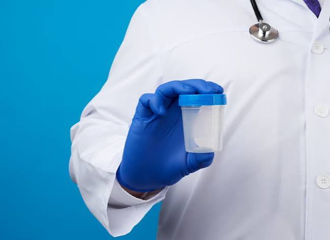 Post Vasectomy Semen Analysis (PVSA) Test